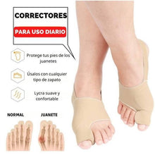 Cargar imagen en el visor de la galería, Corrector ortopédico de juanetes
